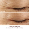 image:imageAdvanced Retinol  Ferulic Triple Correction Eye Serum 15ml05oz