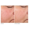 image:imageDr Dennis Gross Advanced Retinol  Ferulic Texture Renewal Serum  AntiAging Formula to Smooth Texture Boost Radiance and Minimize Fine Lines amp Wrinkles 1 oz