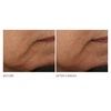 image:imageDr Dennis Gross Advanced Retinol and Ferulic Intense Wrinkle Cream White 2 Ounce Pack of 1