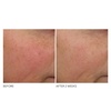 image:imageDr Dennis Gross Advanced Retinol and Ferulic Overnight Wrinkle Treatment White 1 oz 30 mLWhite
