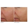 image:imageDr Dennis Gross Advanced Retinol and Ferulic Overnight Wrinkle Treatment White 1 oz 30 mLWhite