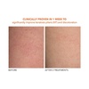 image:imageDr Dennis Gross Alpha Beta Exfoliating Body Treatment  MultiTasking Powered by AHABHAs for Smooth Hydrated Skin While Improving Ingrown Hairs Keratosis Pilaris and Blemishes  2 Textured Towels