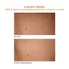 image:imageDr Dennis Gross Alpha Beta Exfoliating Body Treatment  MultiTasking Powered by AHABHAs for Smooth Hydrated Skin While Improving Ingrown Hairs Keratosis Pilaris and Blemishes  2 Textured Towels