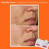 image:imageDr Dennis Gross Alpha Beta Extra Strength Exfoliating Daily Peel  30 Pack5 Count Pack of 1