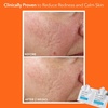 image:imageDr Dennis Gross Alpha Beta Ultra Gentle Exfoliating Daily Peel  30 Pack5 Count Pack of 1