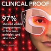 image:imageDr Dennis Gross DRx SpectraLite EyeCare Max Pro LED Device