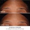 image:imageDr Dennis Gross DermInfusions Fill  Repair Serum Immediately Fills Lines Plumps amp Repairs 1 oz1 Fl Oz Pack of 1