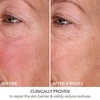 image:imageDr Dennis Gross DermInfusions Fill  Repair Serum Immediately Fills Lines Plumps amp Repairs 1 oz1 Fl Oz Pack of 1