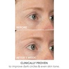 image:imageDr Dennis Gross DermInfusions Lift  Repair Eye Mask  Visibily Lift  Firm Fills the Appearance of Fine Lines Hydrates  Repairs Skin Barrier Visibly Depuffs Undereye Area  1 Treatment 033 fl oz4 Count Pack of 1