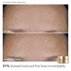 image:imageDr Dennis Gross Plump amp Smooth Limited Edition Kit  DermInfusions Blur  Repair Cream 067 oz  5 Alpha Beta Universal Daily Peels  50 Value
