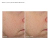 image:imageDr Dennis Gross VitCLactic OilFree Radiant Moisturizer 17 fl oz50mlNo Color