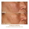 image:imageDr Dennis Gross Vitamin C Lactic 15 Firm amp Brighten SerumYellow