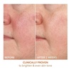 image:imageDr Dennis Gross Vitamin C Lactic 15 Firm amp Brighten SerumYellow