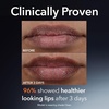 image:imageDr Dennis Gross DermInfusions Plump  Repair Tinted Lip Treatment Berry  Visibly Plumps amp Defines Lips with Hyaluronic Acid amp Peptides  Repairs Moisture Barrier  4 mLBeige