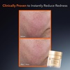 image:imageDr Dennis Gross DermInfusions Blur  Repair Cream Instantly Blurs Fine Lines Smooths Skin with SatinMatte Finish Visibly Plumps amp Firms Reduces Redness and Improves Skin Elasticity 17 Fl Oz