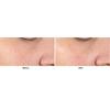 image:imageDr Dennis Gross Alpha Beta Pore Perfecting amp Refining Serum for Enlarged Clogged Pores with Excessive Oil 10 fl oz